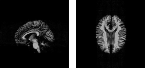 MRISIMUL - brain phantom